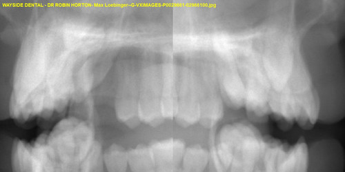 Max Loebinger G VXIMAGES P0029661 02966100.jpg
