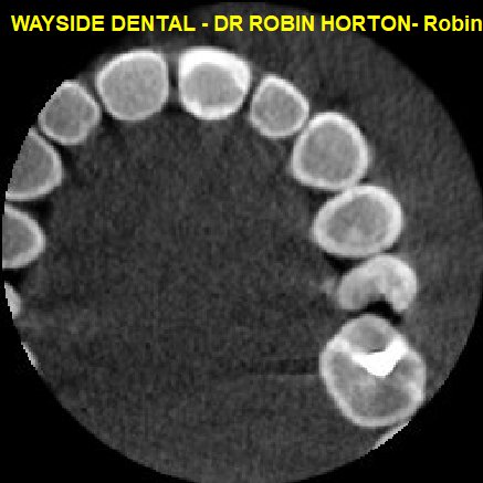 Robin Horton G VXIMAGES 12859 01285900.jpg