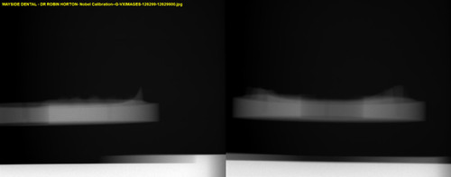 Nobel Calibration G VXIMAGES 126299 12629900.jpg