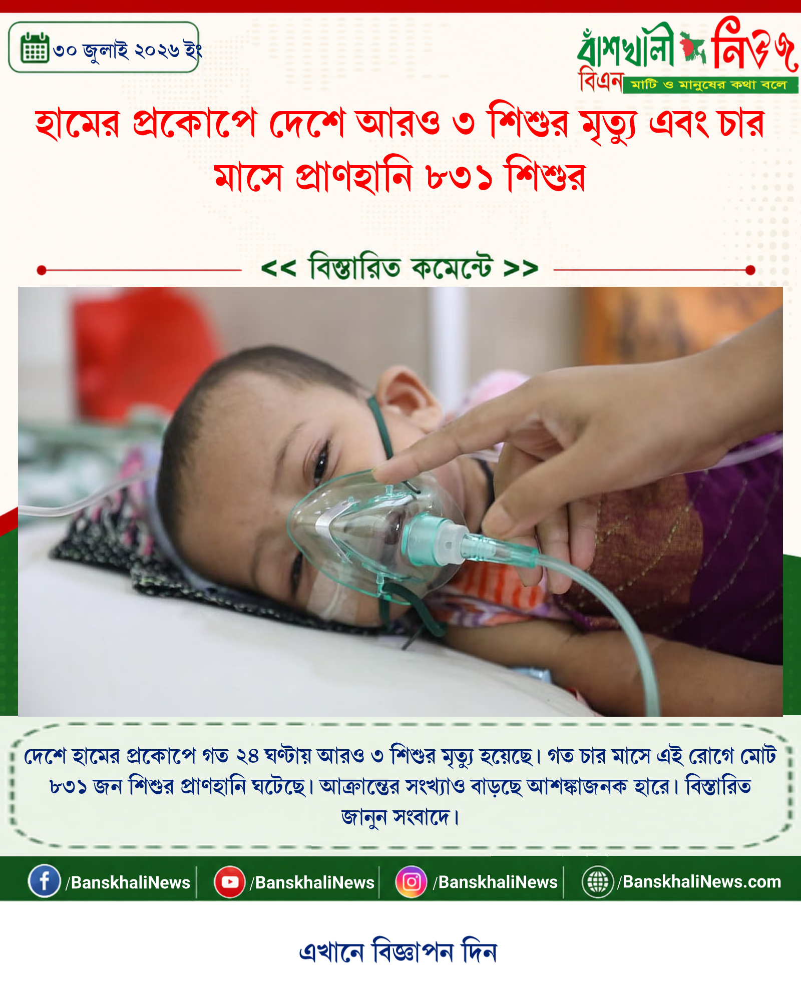 হামের প্রকোপে দেশে আরও ৩ শিশুর মৃত্যু এবং চার মাসে প্রাণহানি ৮৩১ শিশুর
