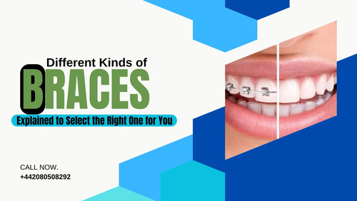 Different Kinds of Braces Explained to Select the Right One for You(1).jpg