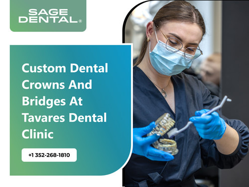 Custom Dental Crowns and Bridges at Tavares Dental Clinic.jpg