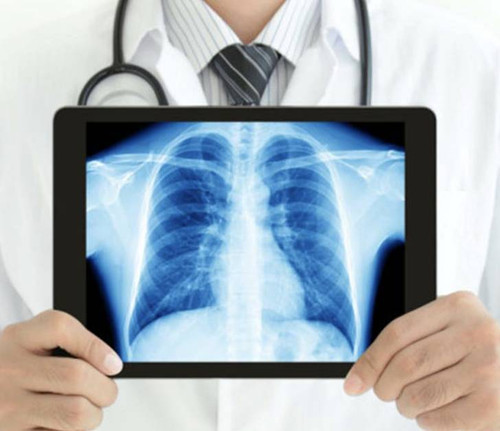 Get Advanced X-ray Services in Rwanda at Frontier Diagnostic Centre.jpg