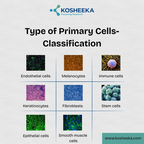 Type of Primary Cells Classification (1).jpg