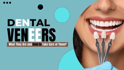 Dental Veneers What They Are and How to Take Care of Them.jpg