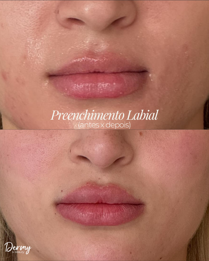 Caso de Antes e Depois 5