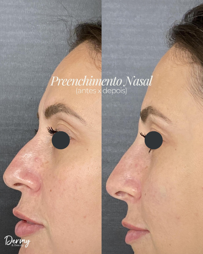 Caso de Antes e Depois 4