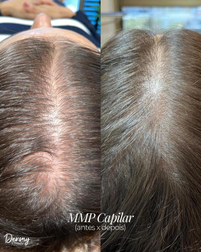 Caso de Antes e Depois 3