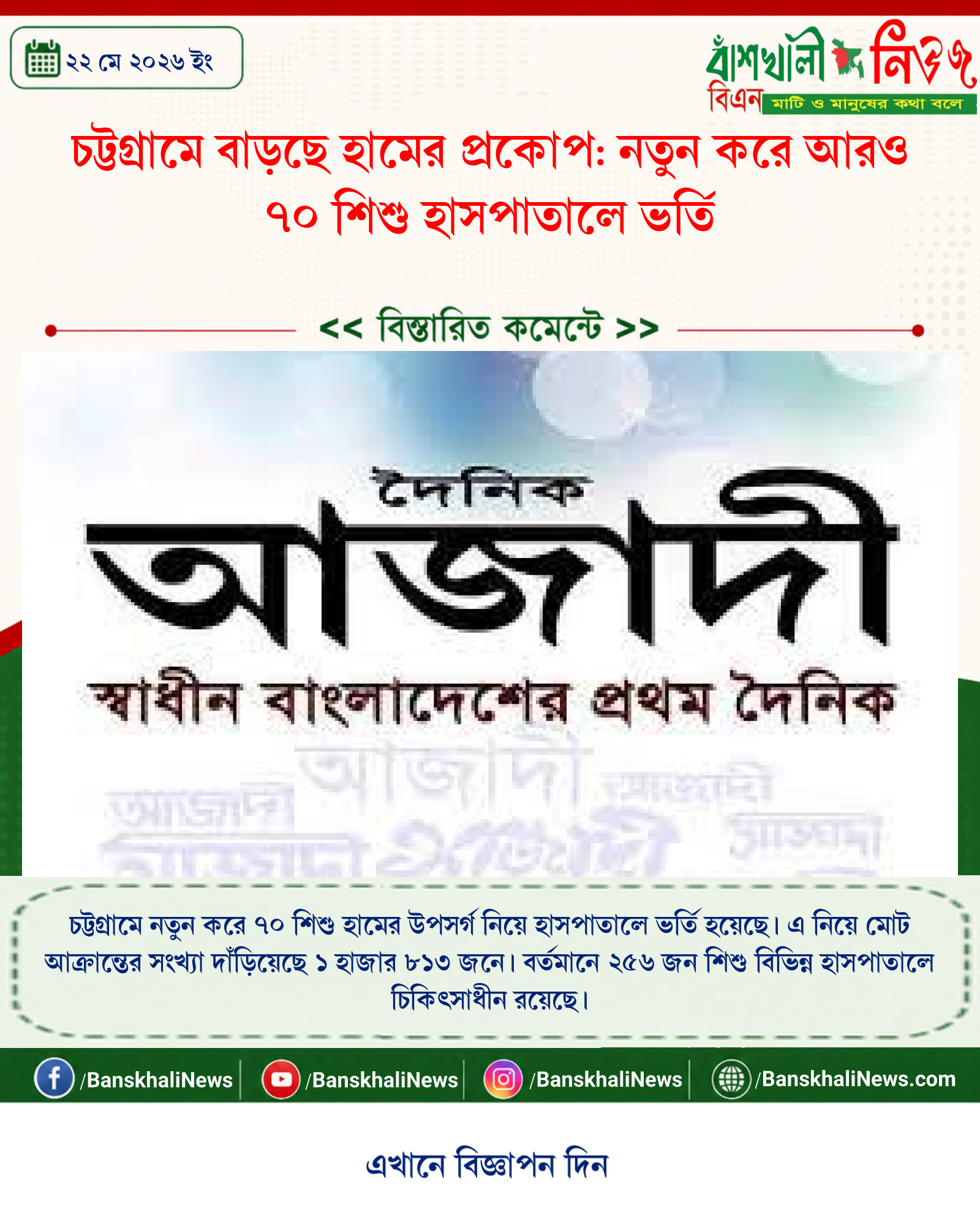 চট্টগ্রামে বাড়ছে হামের প্রকোপ: নতুন করে আরও ৭০ শিশু হাসপাতালে ভর্তি