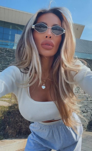 zlatkaa 1772627822 604875379.mp4 (0 00 09) 000037.jpg