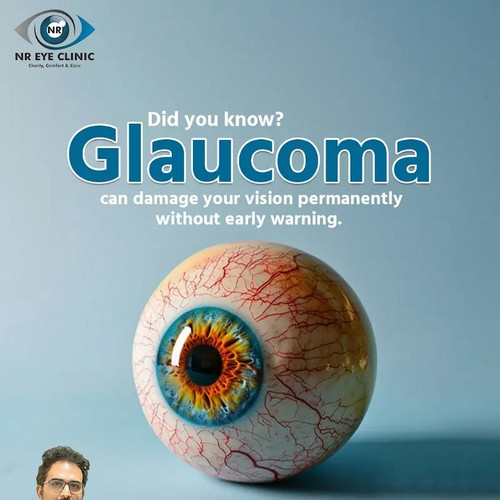 Glaucoma Awareness The Silent Threat to Vision.jpg