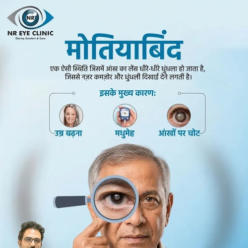 Understanding Cataracts Causes and Symptoms.jpg