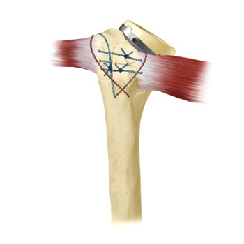 da2fb61bfd39.png