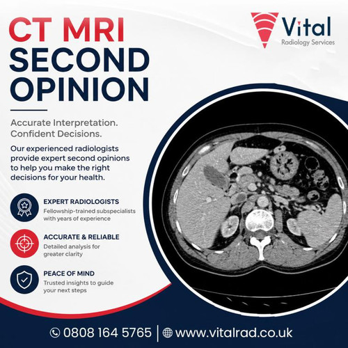 CT MRI second opinion.jpg
