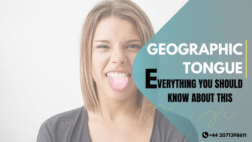 Geographic Tongue Everything You Should Know About This.jpg