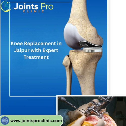 Knee Replacement in Jaipur with Expert Treatment.jpg