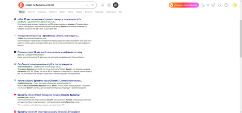 ставят ли брекеты в 35 лет .png