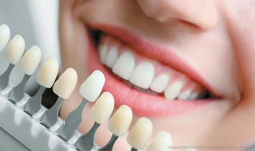Dr phil dds-Teeth Whitening Treatment Plainview.jpg