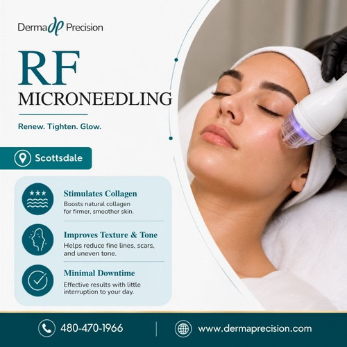 RF Microneedling in Scottsdale.jpg
