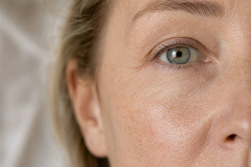 wix under eye.jpg