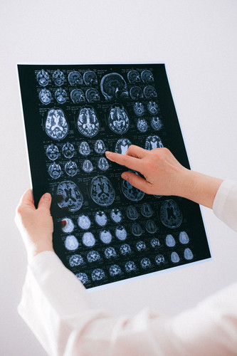 Neurological Treatment Center in Nellore | Medicover Hospitals.jpg