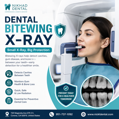 Dental Bitewing X Ray | Nikhad Dental.png
