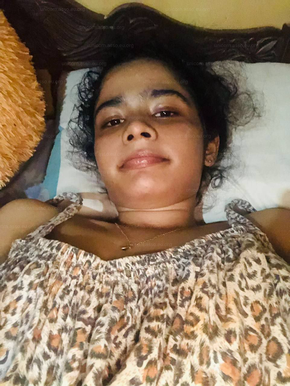 17