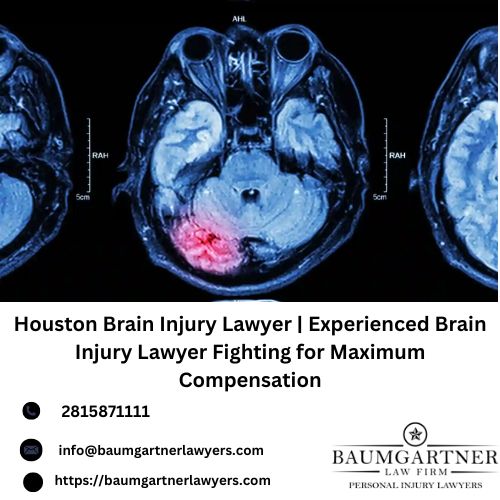 Houston Brain Injury Lawyer Experienced Brain Injury Lawyer Fighting for Maximum Compensation(1).jpg