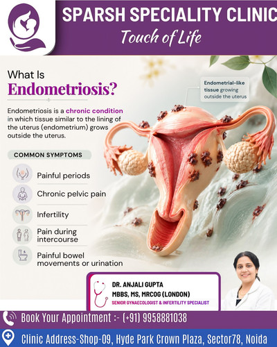 Best Gynaecologist in Noida Dr Anjali Gupta.jpg