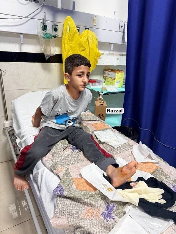 إصابة طفل 9 سنوات بشظايا رصاص من قوات الاحتلال خلال اقتحام حي النقار بمدينة قلقيلية، فجر اليوم....