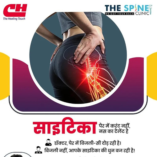 Unmasking Sciatica That Sharp Shooting Pain Down Your Leg.jpg