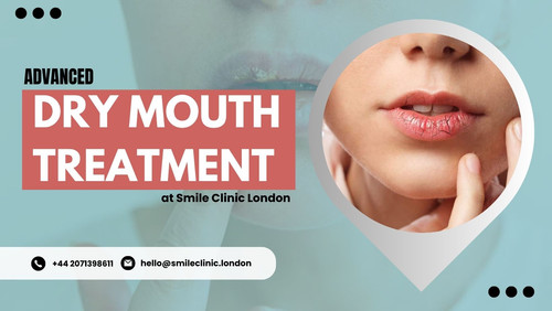 Advanced Dry Mouth Treatment at Smile Clinic London.jpg