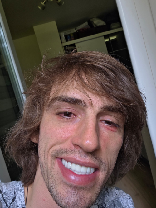 temp.png