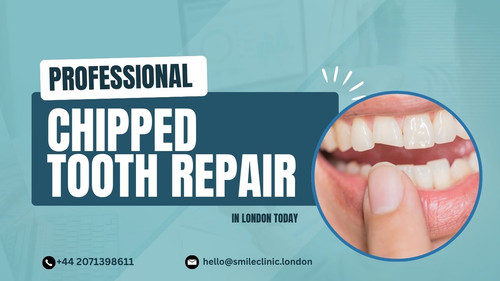Professional Chipped Tooth Repair in London Today.jpg