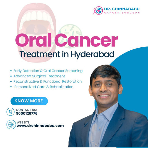 Oral Cancer Treatment (1).jpg