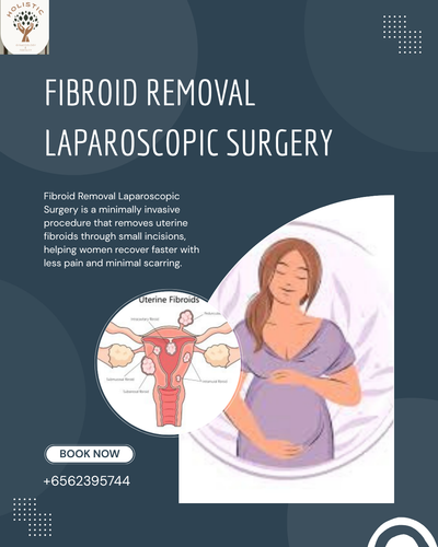 Fibroid Removal Laparoscopic Surgery (5).png