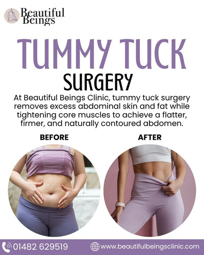 tummy tuck surgery.jpg