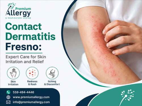Contact Dermatitis Fresno Expert Care for Skin Irritation and Relief.jpg