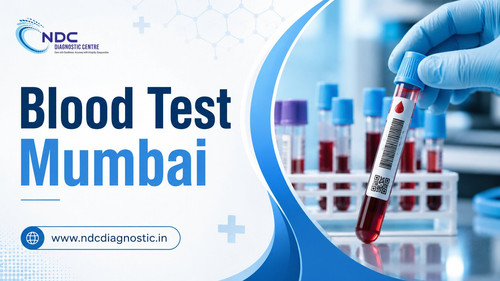 Blood Test Mumbai For Accurate Health Screening.jpg
