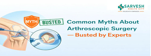 common myths about arthroscopic surgery busted by experts.jpg