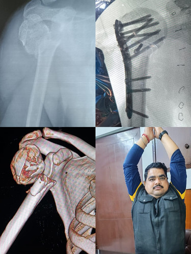 Orthopedic Clinic in Noida for Knee, Shoulder & Spine Treatment.jpg
