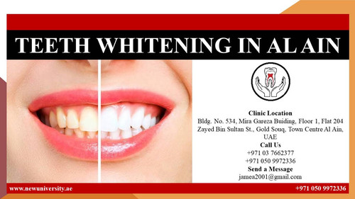 TEETH WHITENING IN AL AIN.jpg