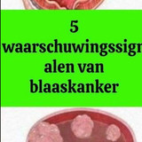 CXDFDFS (29)