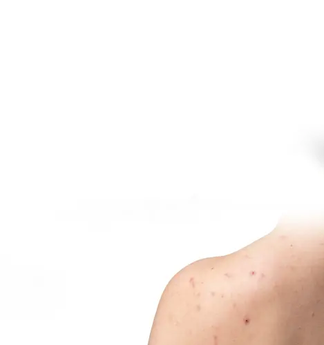 dermatology 1.webp