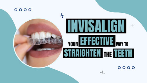 Invisalign Your Effective Way to Straighten the Teeth.jpg