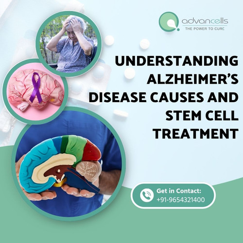 Alzheimer's Disease Causes.jpg