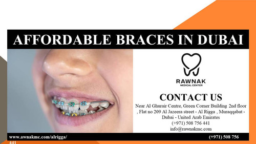 AFFORDABLE TOOTH FILLING IN ALRIGGA.jpg