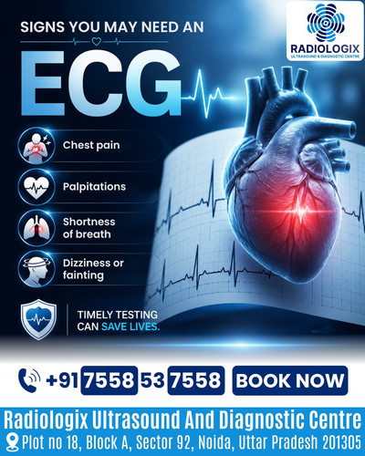 Signs You May Need an ECG ECG Test at Radiologix Ultrasound and Diagnostic Centre.jpg