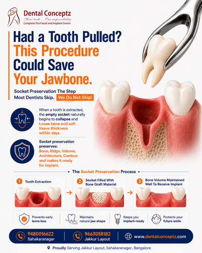 Had a Tooth Pulled This Procedure Could Save Your Jawbone.jpg
