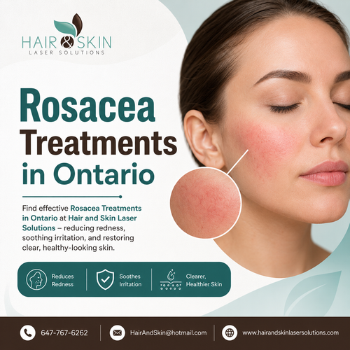 Healthy Skin Begins with Rosacea Treatments in Ontario.png